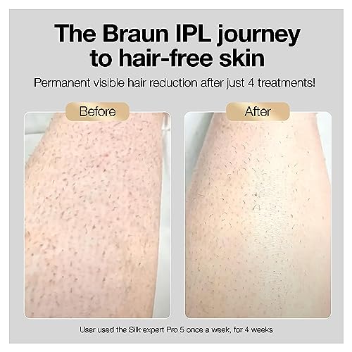 Braun Depilación IPL de larga duración para mujeres y hombres, New Silk Expert Pro 5 PL5157, para cuerpo y rostro, sistema de depilación de larga duración, alternativa a la depilación láser de salón, con afeitadora Venus, bolsa